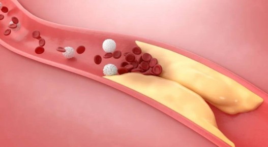 Продукты, которые помогут сохранить здоровье сердца и снизить холестерин