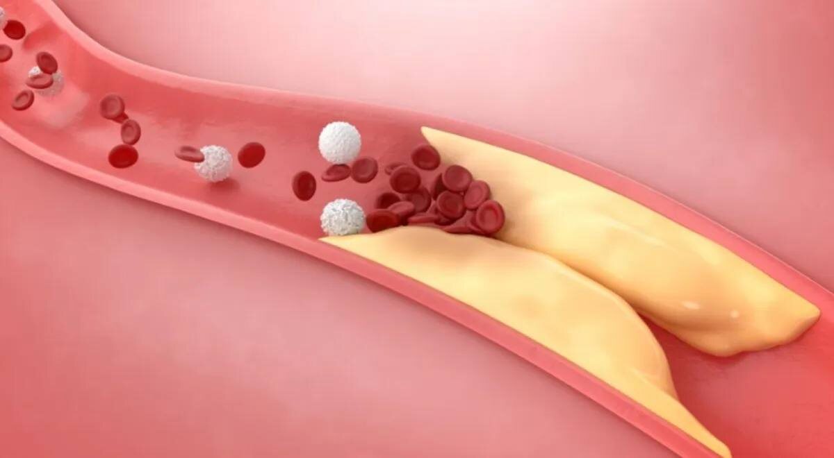 Продукты, которые помогут сохранить здоровье сердца и снизить холестерин