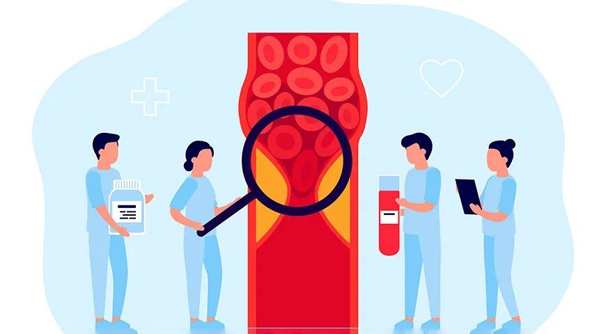 ����������� ������� ��� �������������: ������� �������� � ����������