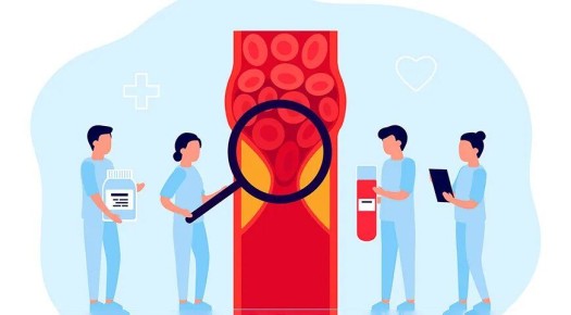 ����������� ������� ��� �������������: ������� �������� � ����������